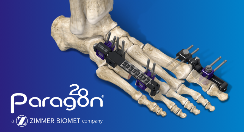 Zimmer Biomet Debuts New Foot and Ankle Fixation System
